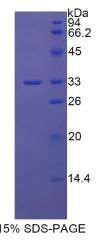 Recombinant Glycoprotein 39, Cartilage (GP39)