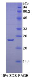 Hypoxia Inducible Factor 2 Alpha (HIF2a)