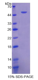 Recombinant Fibrinogen Beta (FGb)