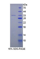 Recombinant Topoisomerase II (TOP2)