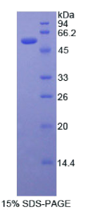 Recombinant Estrogen Receptor Alpha (ERa)