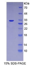 Recombinant Topoisomerase II (TOP2)