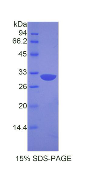 Apoptotic Peptidase Activating Factor 1 (APAF1)