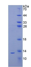 Recombinant Parathyroid Hormone (PTH)