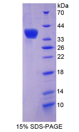 Recombinant Olfactomedin 4 (OLFM4)