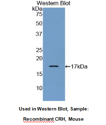 Polyclonal Antibody to Corticotropin Releasing Hormone (CRH)