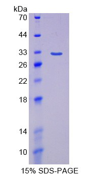 Recombinant Interferon Regulatory Factor 5 (IRF5)