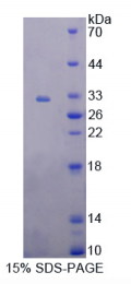 Recombinant Hydroxymethylbilane Synthase (HMBS)