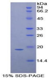 Recombinant Interleukin 1 Receptor Antagonist (IL1RA)