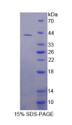 Recombinant Dihydroorotate Dehydrogenase (DHODH)