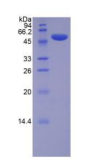 Recombinant Lysyl Oxidase (LOX)