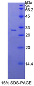 Recombinant Histone Deacetylase 6 (HDAC6)