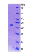 Recombinant Colony Stimulating Factor 1, Macrophage (MCSF)