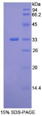 Integrin Beta 1 (ITGb1)