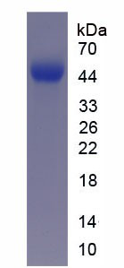 HumanRecombinant Na+ Taurocholate Cotransporting Polypeptide (NTCP)