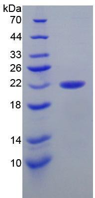 Mouse Recombinant Calreticulin (CRT)