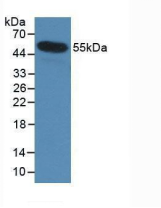 Human Monoclonal Antibody to Interleukin 35 (IL35)