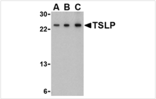 TSLP Antibody