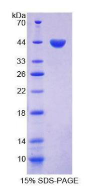 Human Recombinant Follicle Stimulating Hormone (FSH)