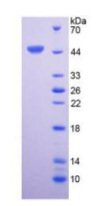 Recombinant Human Interleukin 6 (IL6)