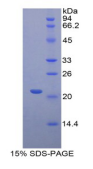 Recombinant Fibrinogen Like Protein 2 (FGL2)