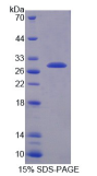 Recombinant Mouse Transmembrane Protease, Serine 2 (TMPRSS2)