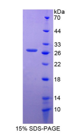 Recombinant Human Glycoprotein 2, Zymogen Granule Membrane (GP2)/ZAP75