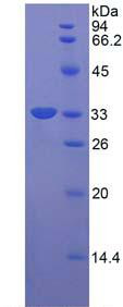 Recombinant Human RAR Related Orphan Receptor Gamma (RORg)