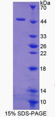 Recombinant Human Hemoglobin Delta (HBd)