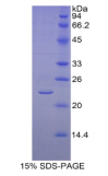 Recombinant Human  Aromatase (ARO)