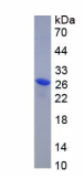 Recombinant Mouse Aromatase (ARO)