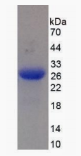 Active Human Mannose Associated Serine Protease 2 (MASP2)