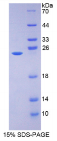 Recombinant 17-Beta-Hydroxysteroid Dehydrogenase Type 10 (HSD17b10)