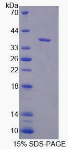 Recombinant Mouse Neurocan (NCAN)