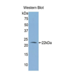 Polyclonal Antibody to Aldehyde Dehydrogenase 1 Family, Member A3 (ALDH1A3)