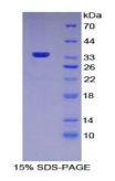 Recombinant Mannose Receptor C Type 1 (MRC1)